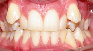 Before & After - McDonald Orthodontics