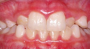 Before & After - McDonald Orthodontics