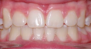 Before & After - McDonald Orthodontics