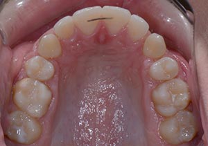 Before & After - McDonald Orthodontics